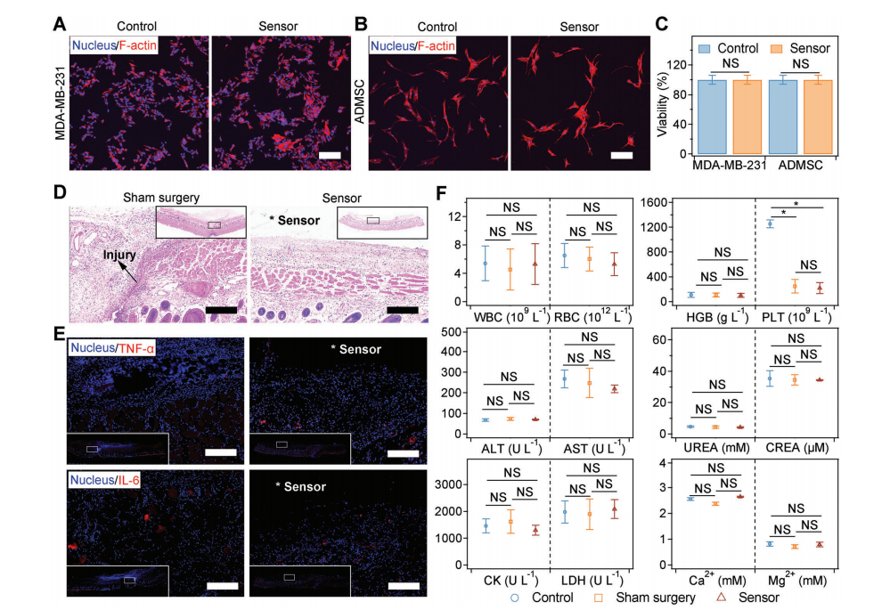 機(jī)械退火破解氨基酸晶體壓電難題!南京大學(xué)造出可生物降解的壓電力傳感器